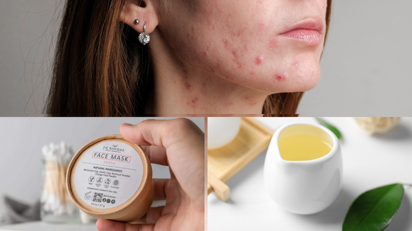 Vegan Clay Mask Recipe for Sensitive, Acne-Prone Skin